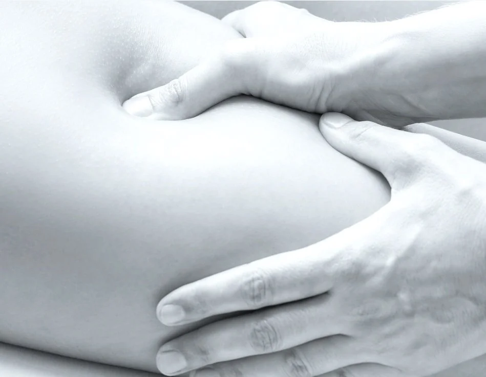 Piriformis Syndrome illustration