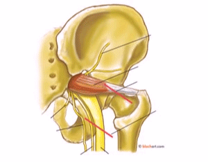 Piriformis Surgery