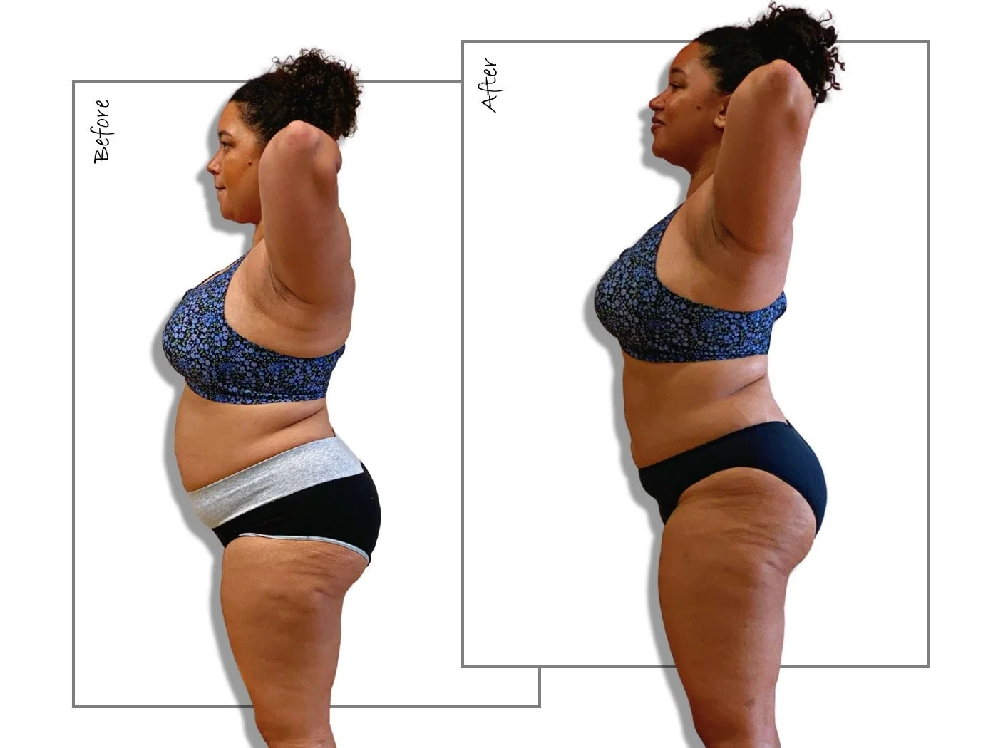 Before and after weight loss transformation, client looks and feels better.