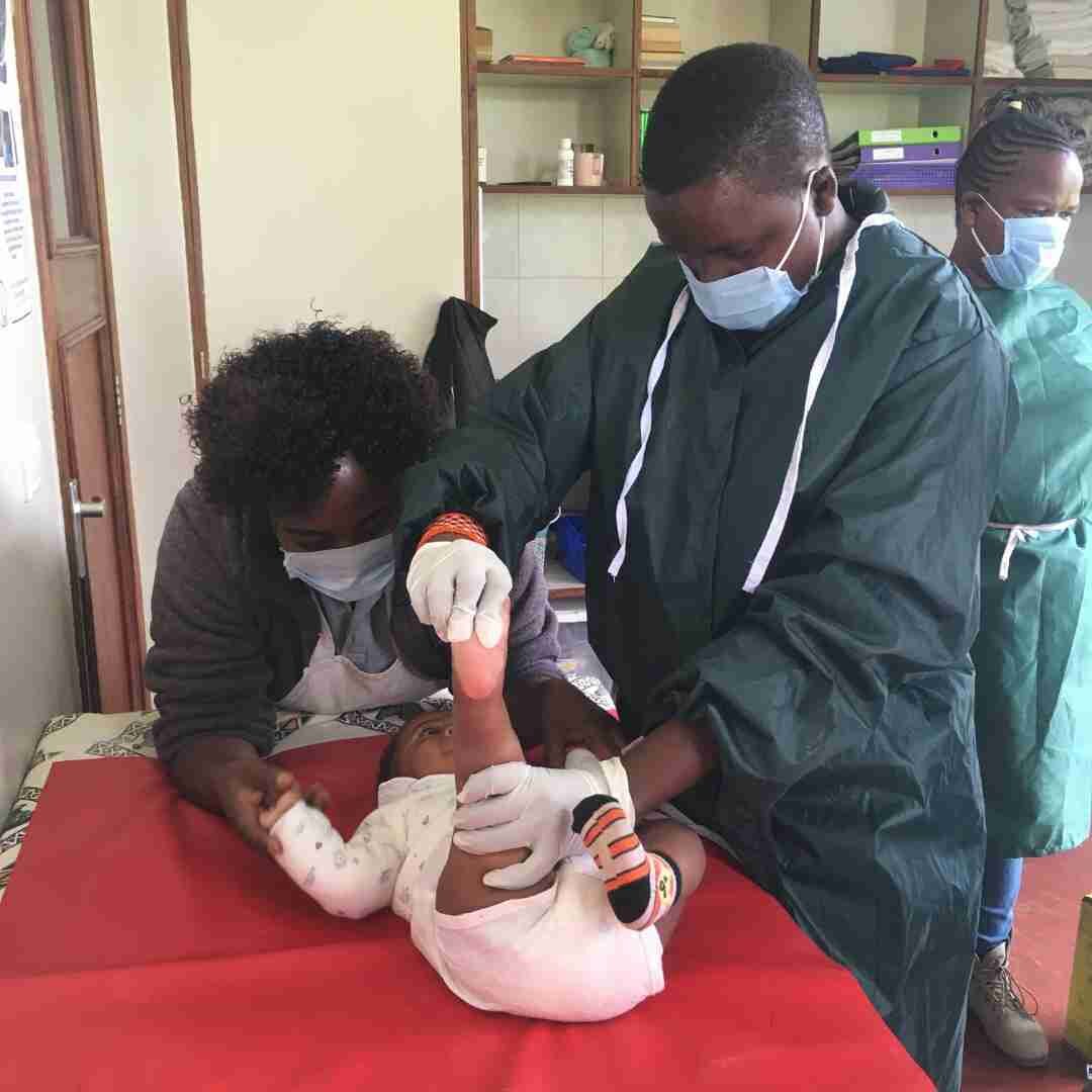 Our Occupational Therapists and Physiotherapists manage clubfoot casting for infants and children of walking age, changing casts each week. 

Some cases can be managed without surgery, but for babies who need a tenotomy, we bring a surgeon in. The si