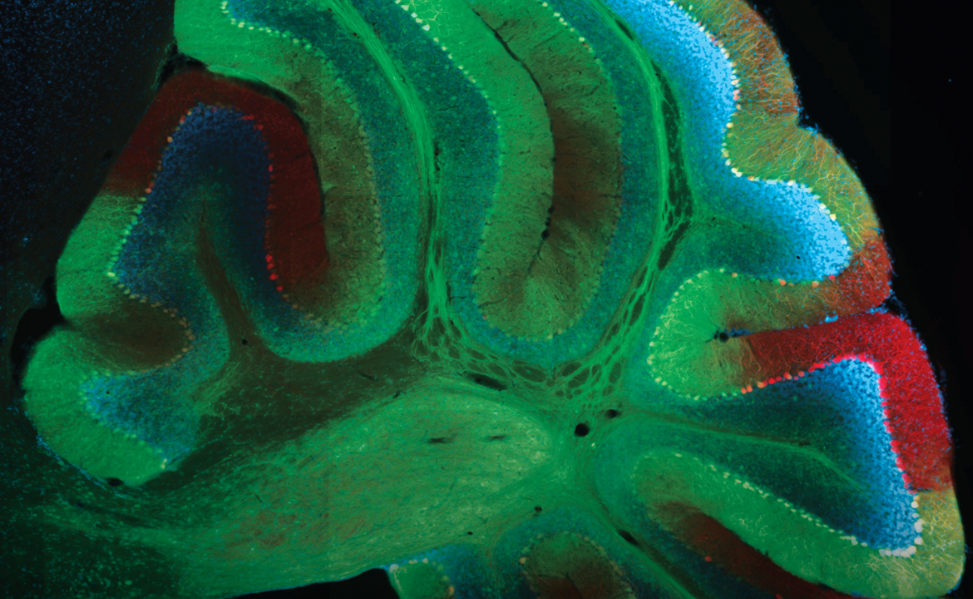 Microscopy image of fluorescently labeled brain tissue.