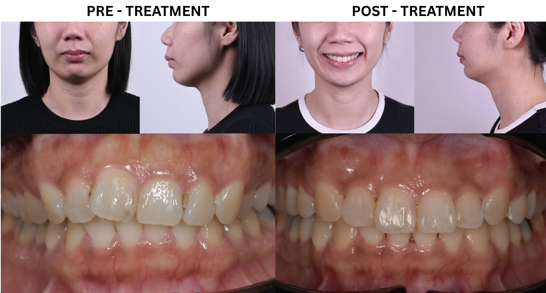 CASE 1