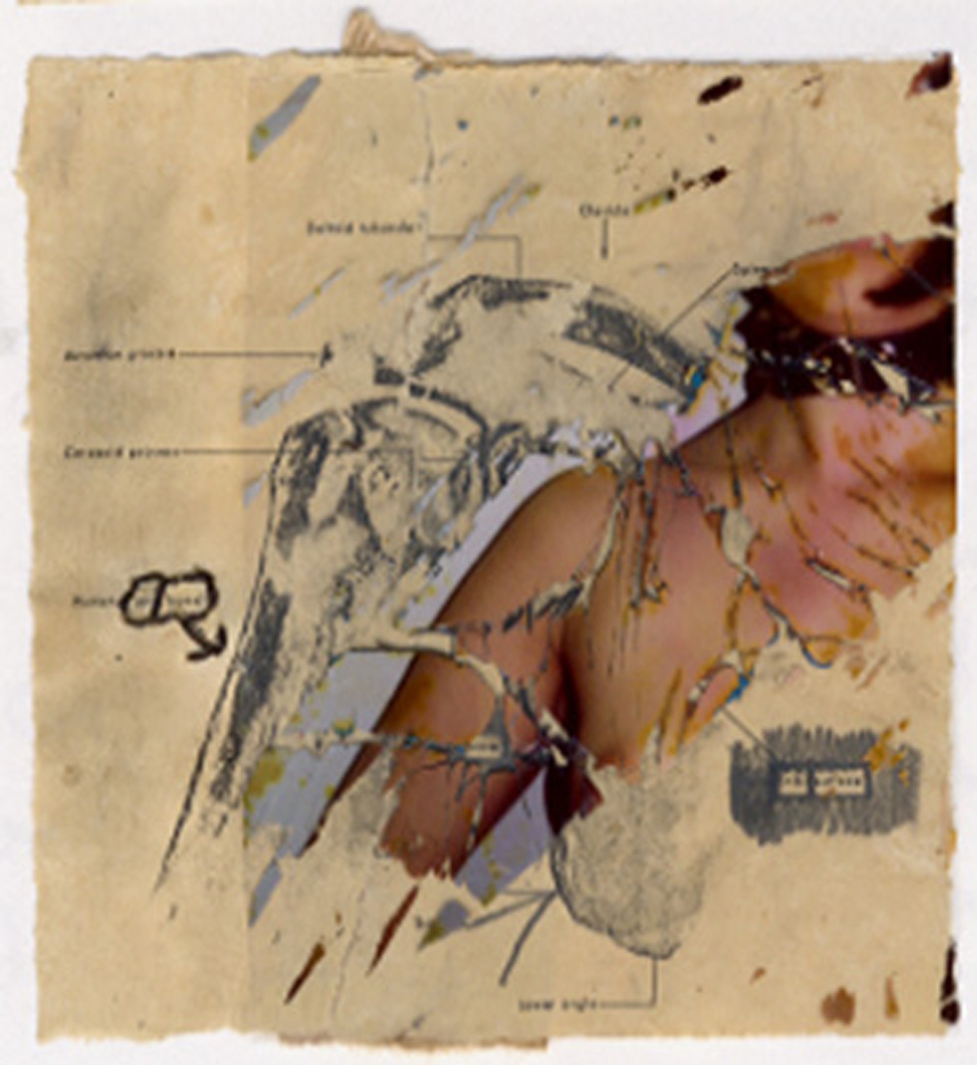 Fuji Instax self-portraits destroyed and overlaid onto medical drawings