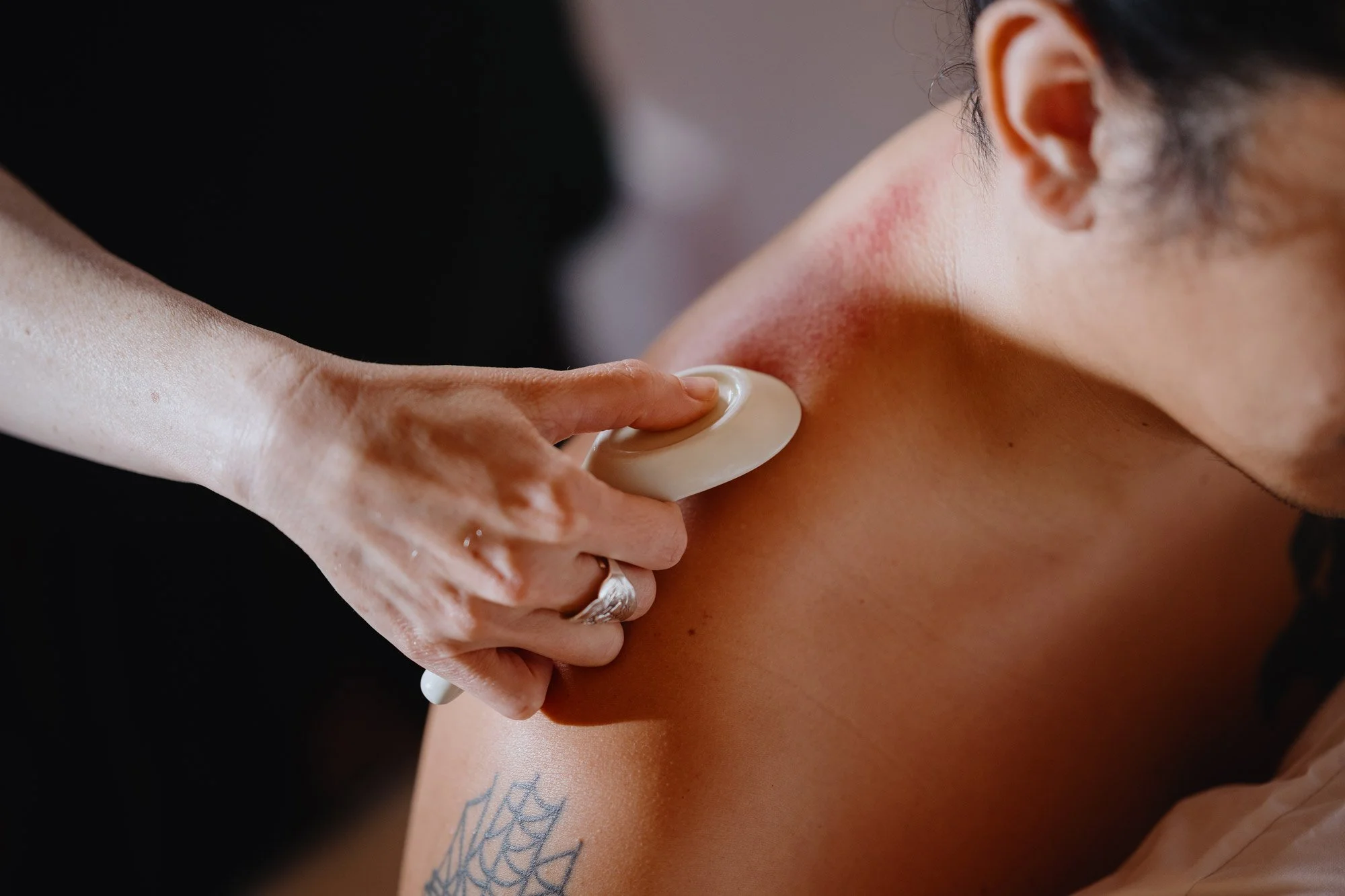 Friendly Acupuncture Clinic: Acupuncture & East Asian Bodywork in Ballard, Seattle WA