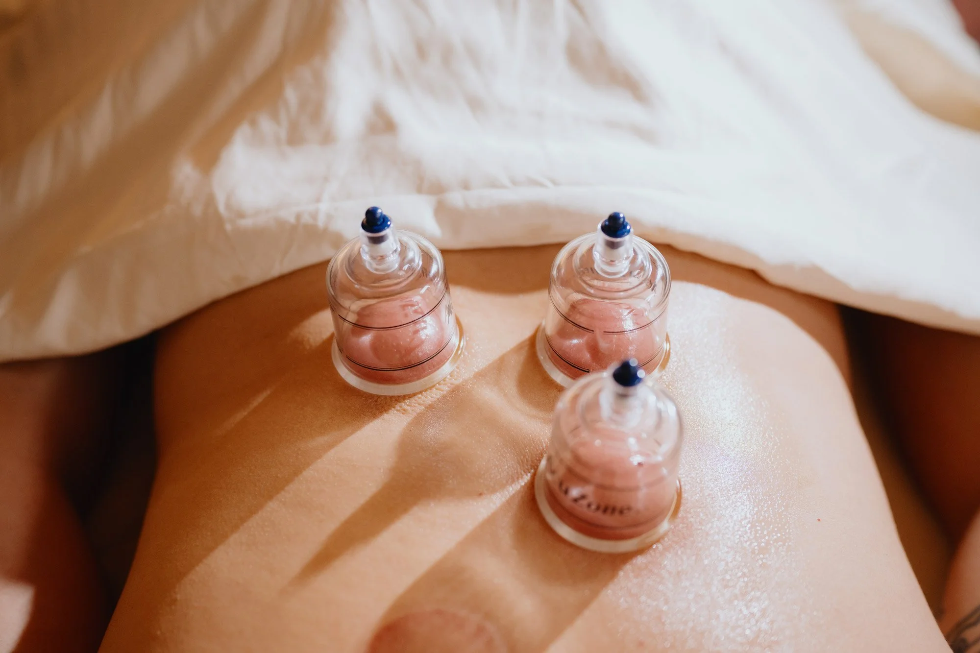 Friendly Acupuncture Clinic: Acupuncture & East Asian Bodywork in Ballard, Seattle WA