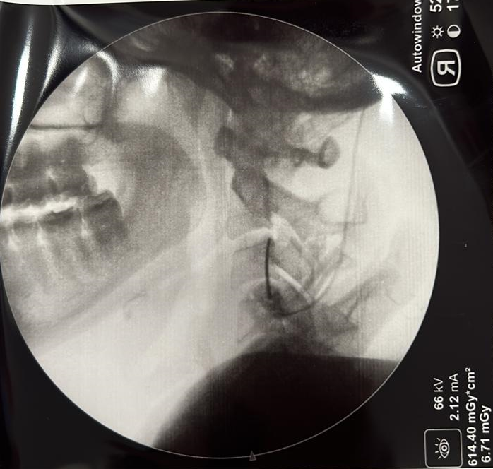 cervical.png