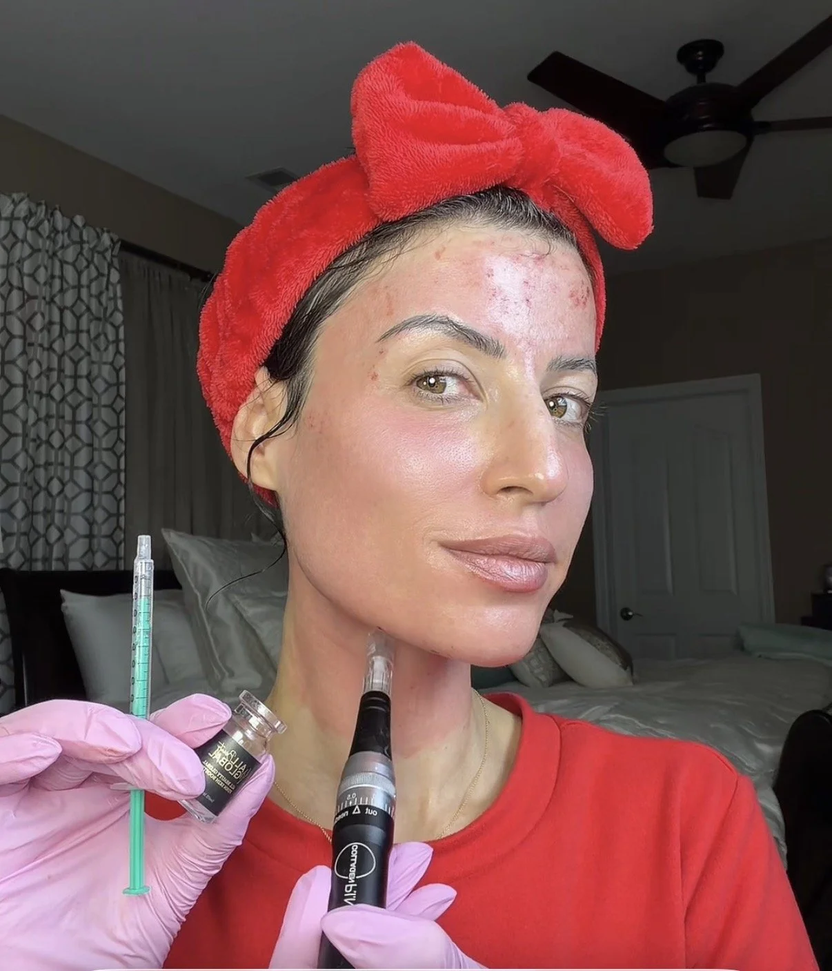 A woman with a red headband, likely a towel, on her head, is preparing to receive a cosmetic injection while wearing pink gloves. She has clear skin and is in a bedroom with a bed and curtains in the background.