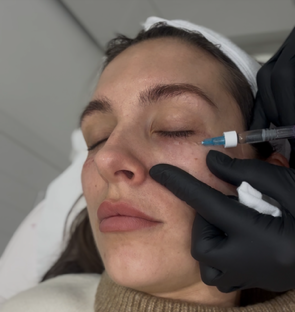 A woman receiving a facial injection from a medical professional wearing black gloves.