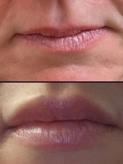 Close-up of human lips with visible fine lines and slight dryness, shown in two different images.