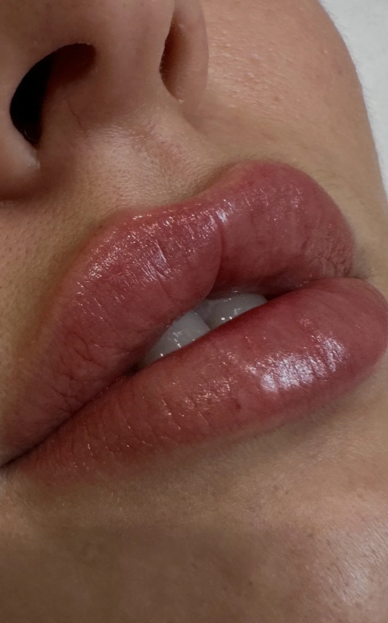 Close-up of a person's lips and nose, with the lips slightly parted and glossy.