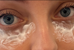Close-up of a person's eyes with white cream or lotion applied under them.