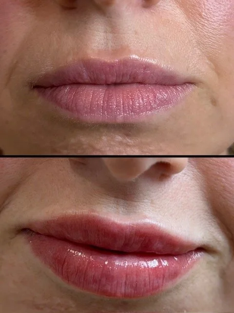Close-up of a person's lips before and after applying lip gloss or treatment, showing smoother, shinier lips in the after image.