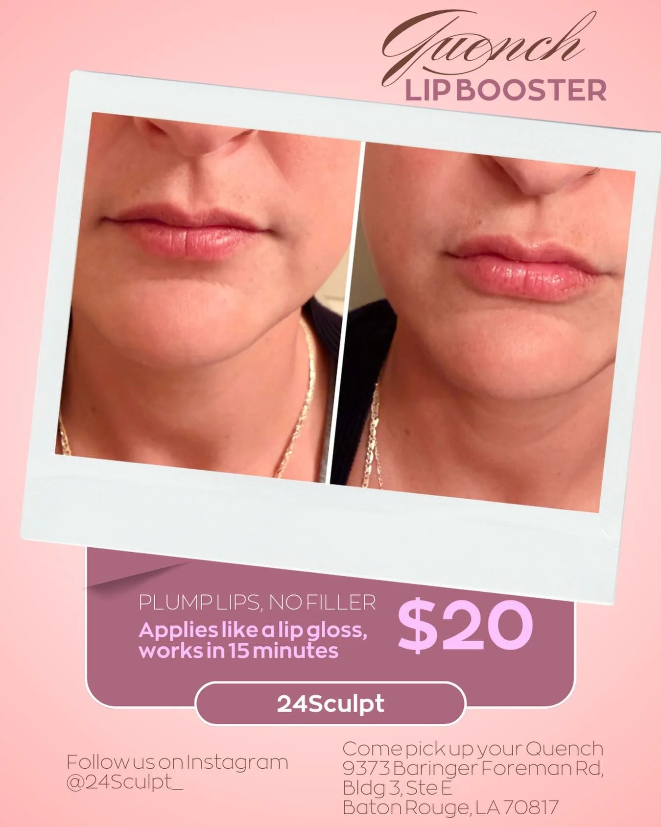 💋 Want fuller lips without filler?

Meet Quench Lip Booster at 24Sculpt.
It applies like lip gloss and gives a natural looking plump in about 15 minutes.

✨ Hydrating
✨ Smooths lips
✨ Subtle volume

Only $20 (4&ndash;5 applications per package).

St