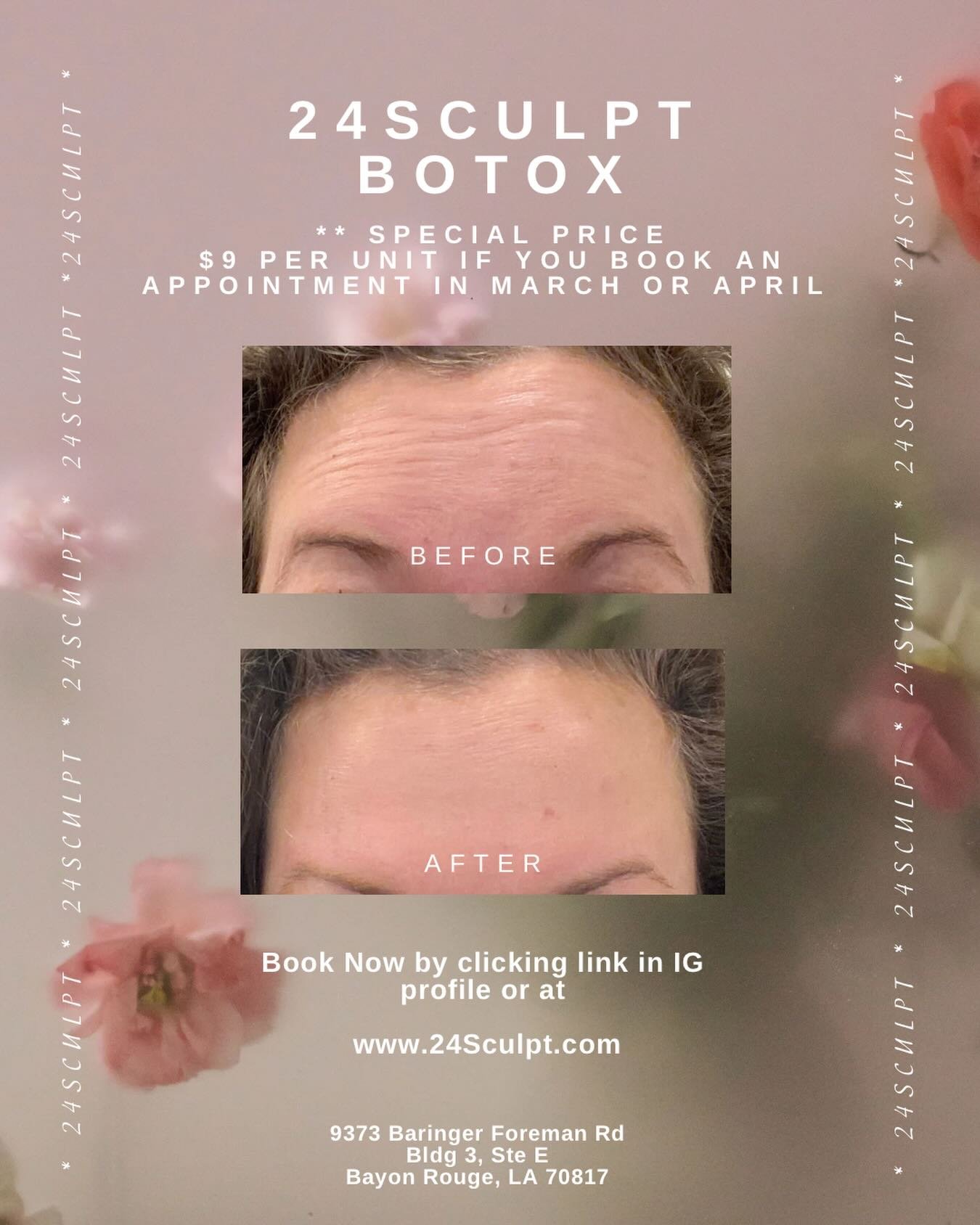 Smooth, refreshed, and still you ✨

This is your sign to finally try Botox 🤍

Say goodbye to fine lines and hello to a softer, more youthful look&mdash;with natural results you&rsquo;ll love.

✨ Special Pricing: $9/unit ✨
Available for appointments 