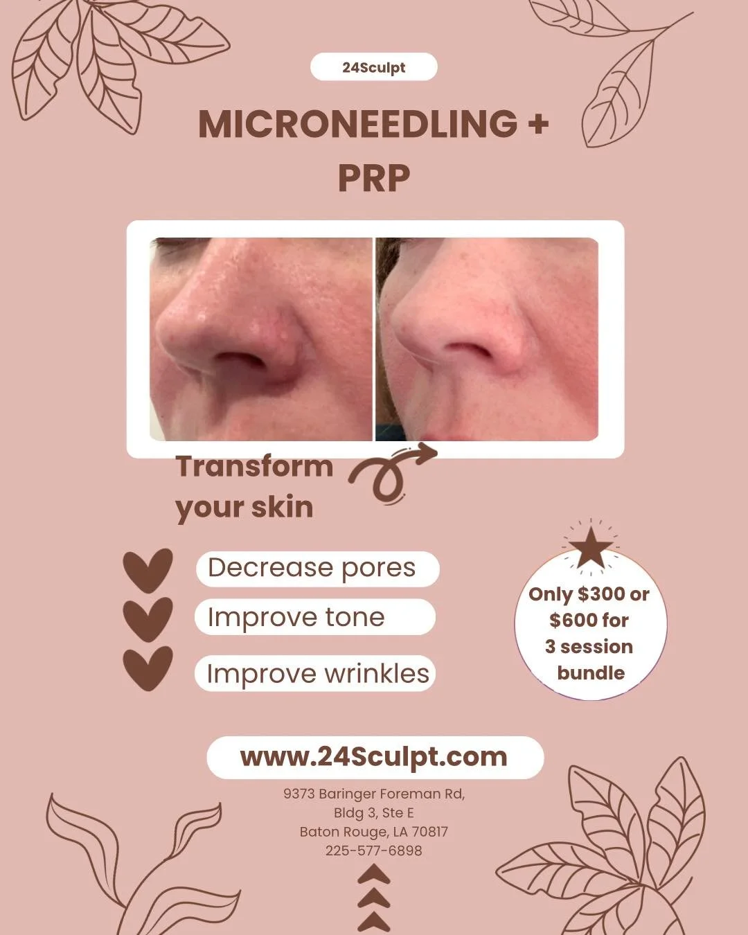 Glow up your skin ✨

Microneedling + PRP works beneath the surface to smooth texture, refine pores, and boost collagen for that natural, radiant finish.

✔️ Smaller pores
✔️ More even tone
✔️ Softer fine lines and wrinkles

Invest in your skin&mdash;