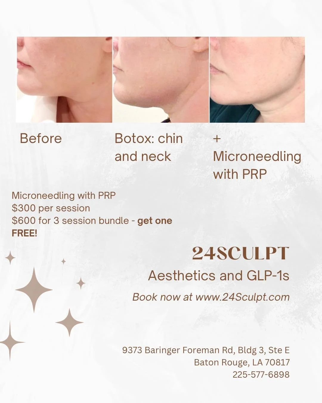 What can microneedling with PRP do? ✨

This transformation shows what happens when we combine targeted wrinkle relaxer in the chin + neck with collagen-boosting microneedling + PRP.

✔️ Smoother texture
✔️ More defined jawline
✔️ Improved tone + firm