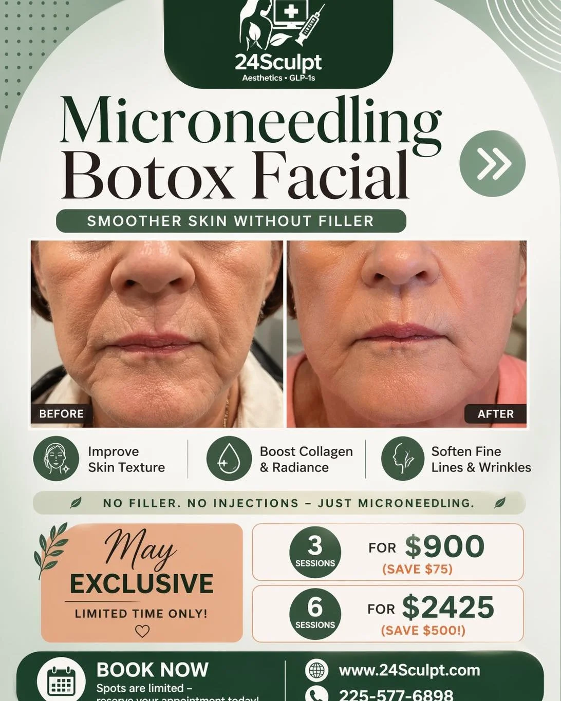 Want smoother skin without filler?

✨ Microneedling Botox Facial

Improve texture, soften lines, and boost collagen&mdash;all in one treatment

1 session $325

🔥 May Special
3 sessions $900
6 sessions $2425

👉 Tap &ldquo;Book Now&rdquo; in our bio 