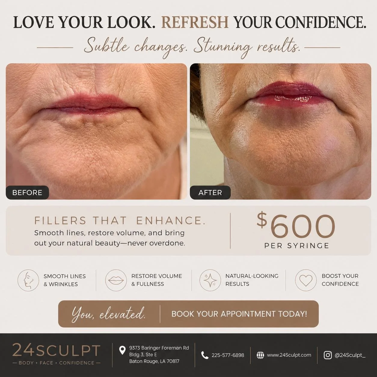 ✨ SUBTLE ENHANCEMENT. BEAUTIFUL RESULTS. ✨

A refreshed appearance doesn&rsquo;t have to look overdone.

Dermal fillers can restore lost volume, soften lines around the mouth, and create smoother facial contours while maintaining a natural look.

✔ R
