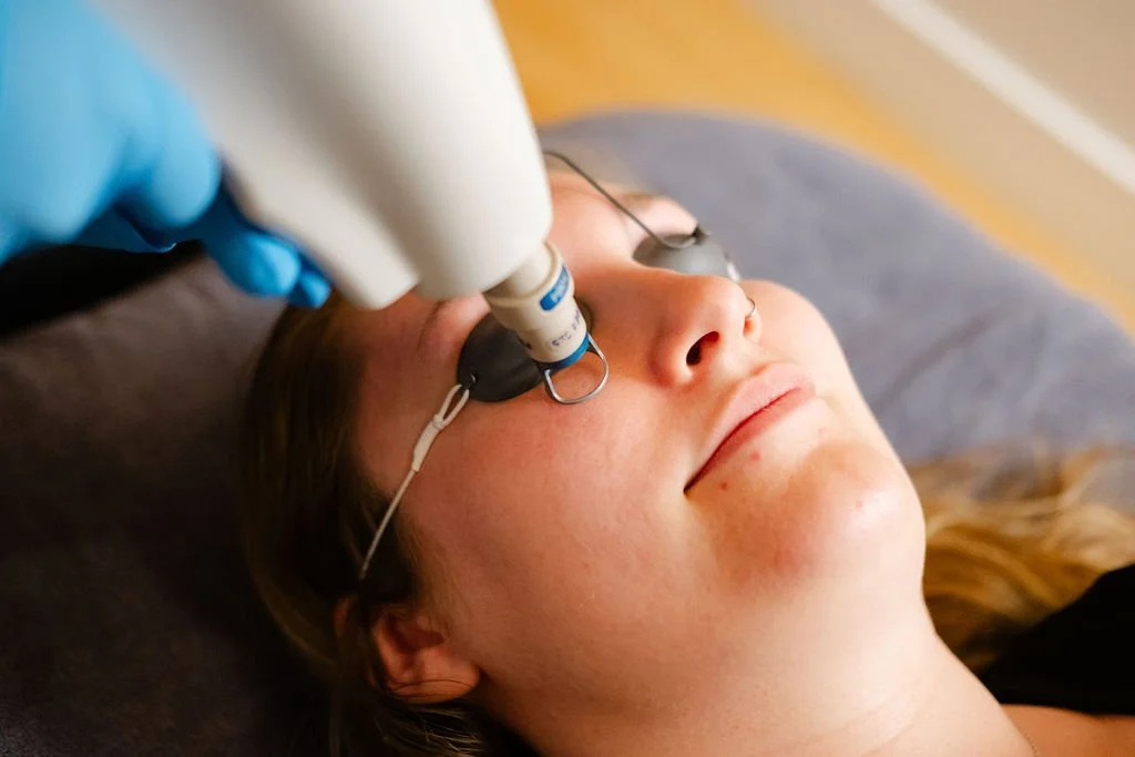 What Is a Laser Facial, and Are They Worth It?