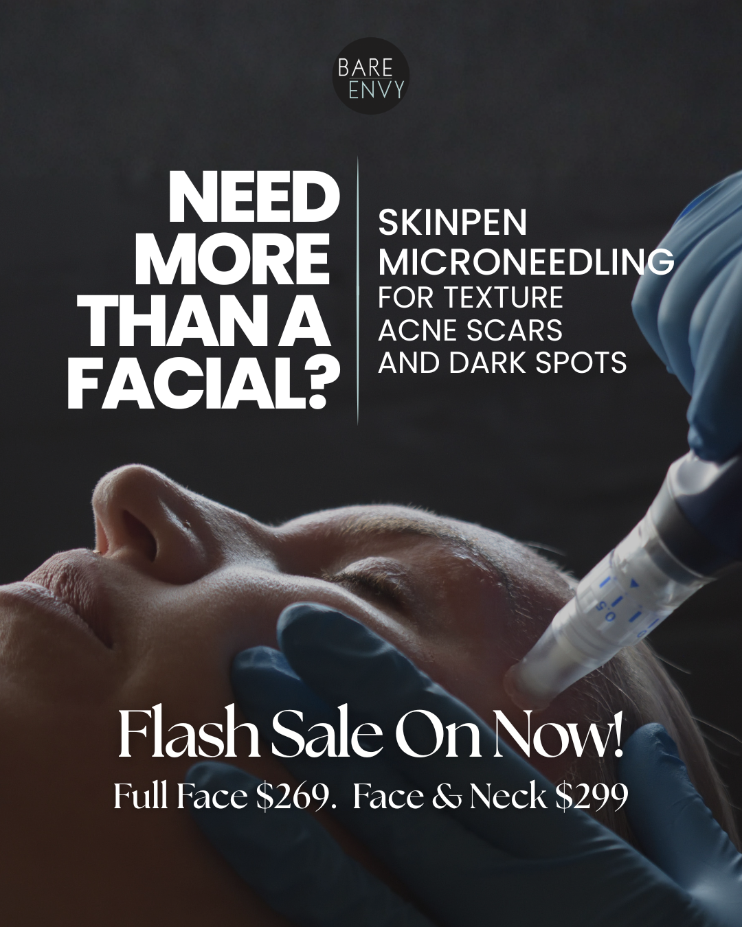 SkinPen Micro-Needling Flash Sale