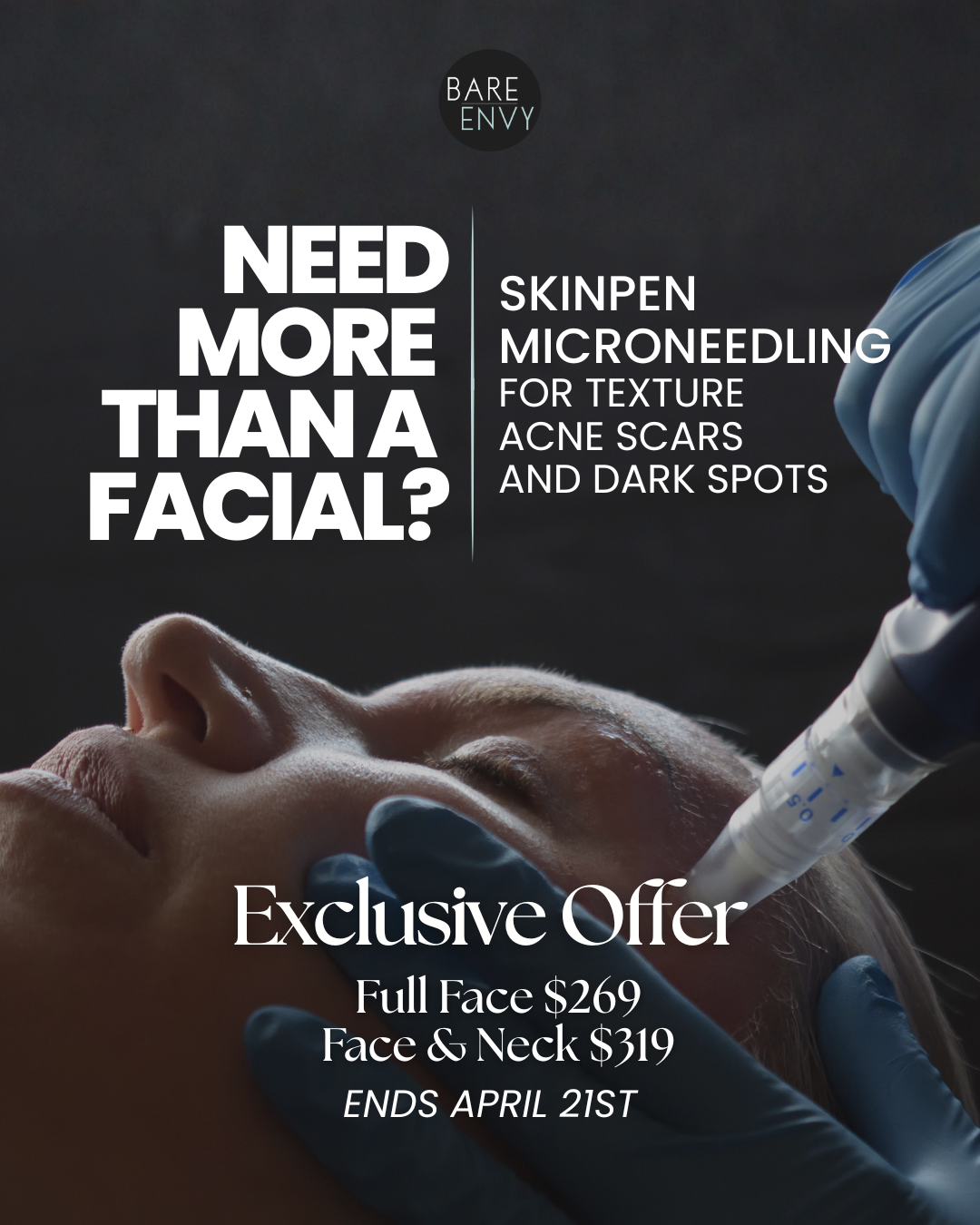 SkinPen Micro-Needling Flash Sale