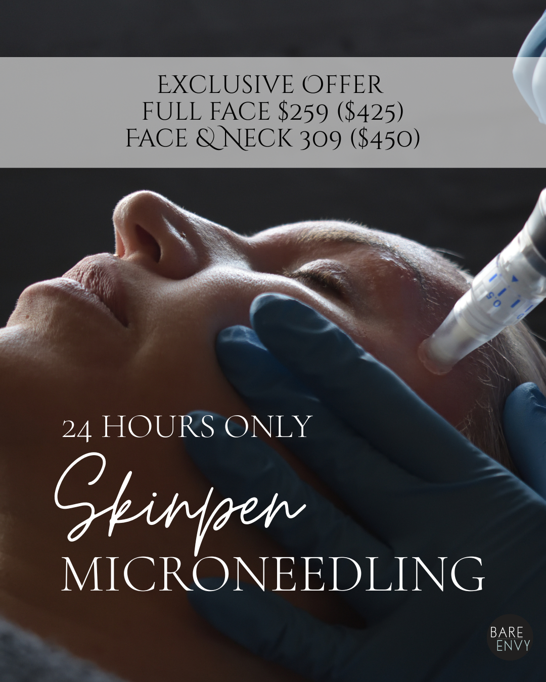 SkinPen Micro-Needling Flash Sale