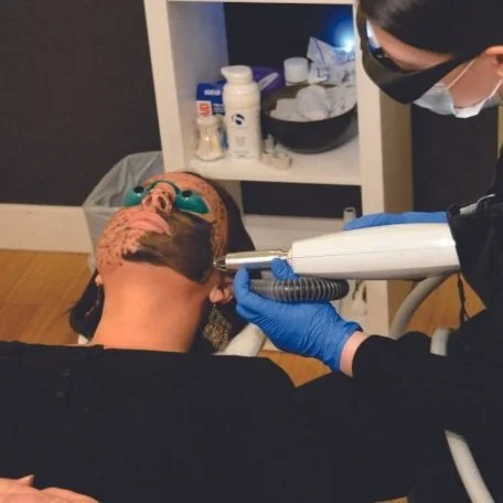 HOLLYWOOD-FACIAL-BARE-ENVY-LASER-REGINA.jpg