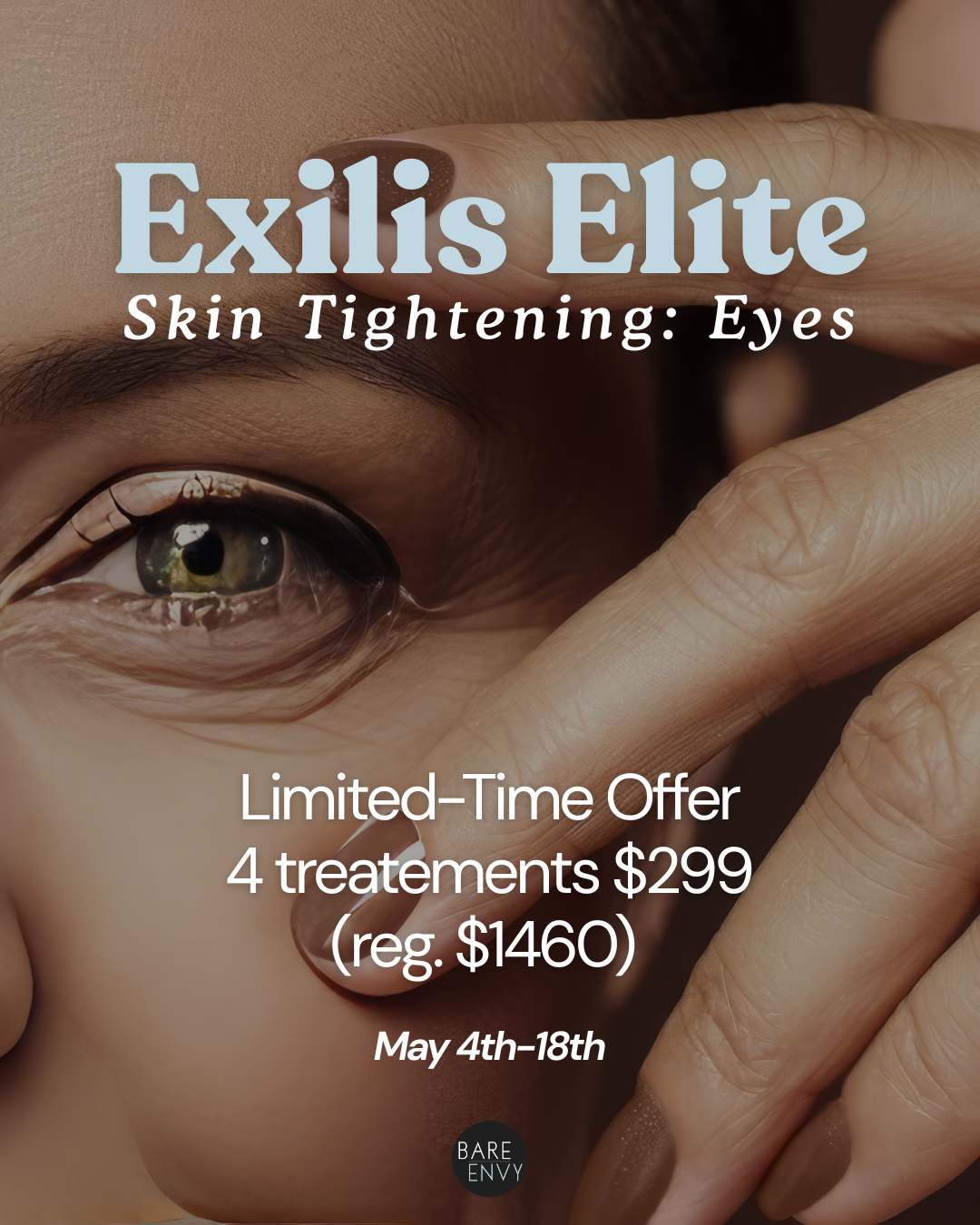 exilis elite flash sale.png