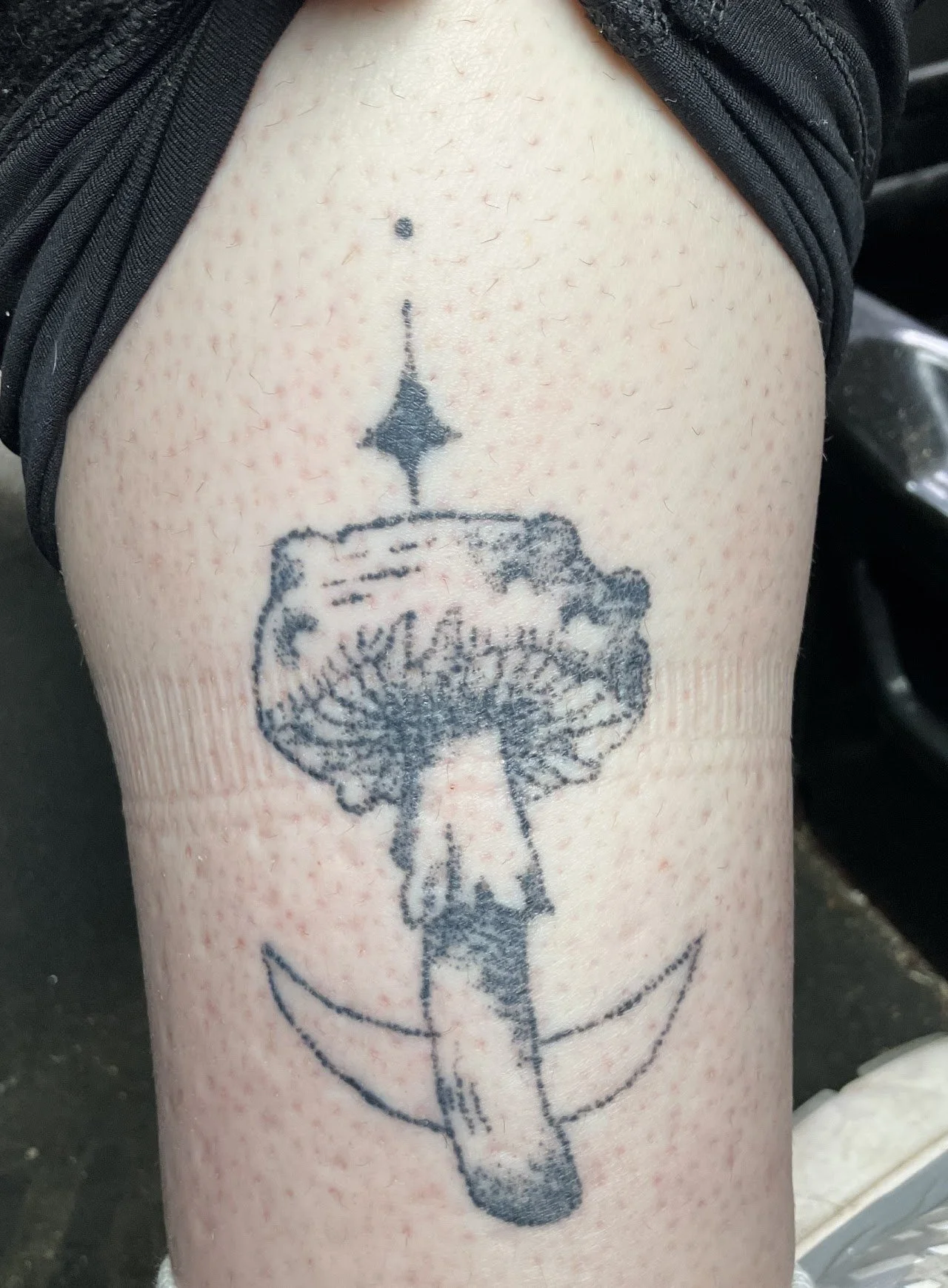 Healed- 3 Months