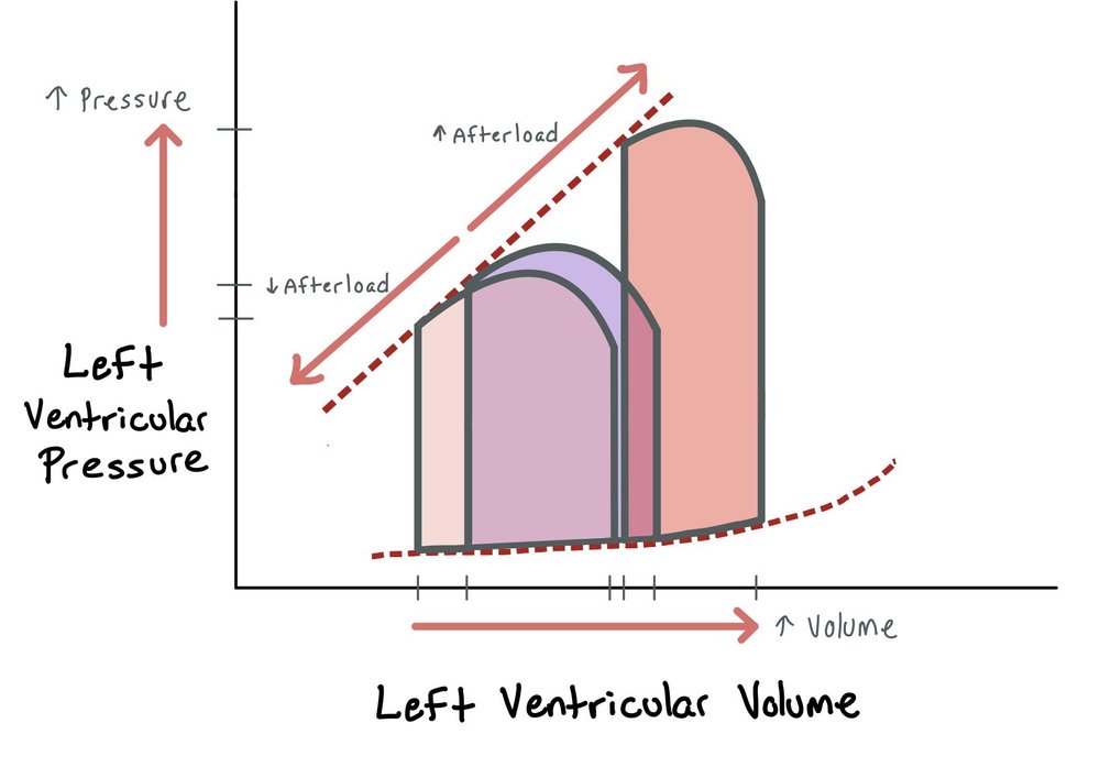 Cardiogenic Shock — When the Beat Drops: A Resident's Guide to the CCU