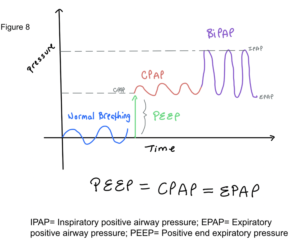 Non-Invasive Positive Pressure Ventilation — When the Beat Drops: A ...