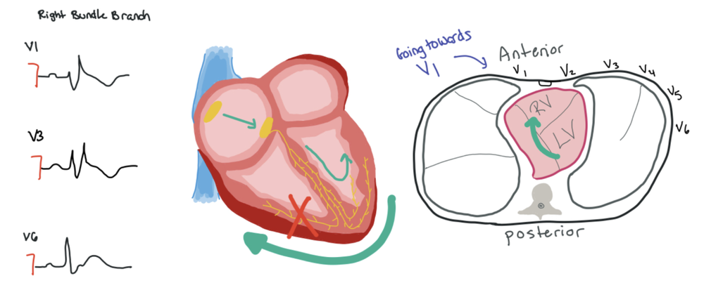 Ekkg Math How to Read EKGs — When the Beat Drops: A Resident's Guide to the CCU