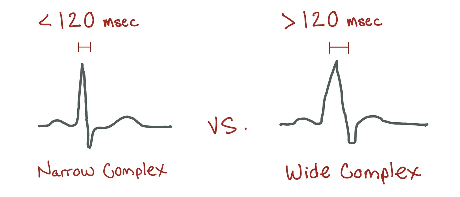 Wide Complex Tachycardia — When the Beat Drops: A Resident's Guide to ...