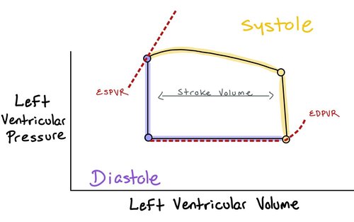 Pv Loop Changes Cardiogenic Shock — When the Beat Drops: A Resident's Guide to the CCU