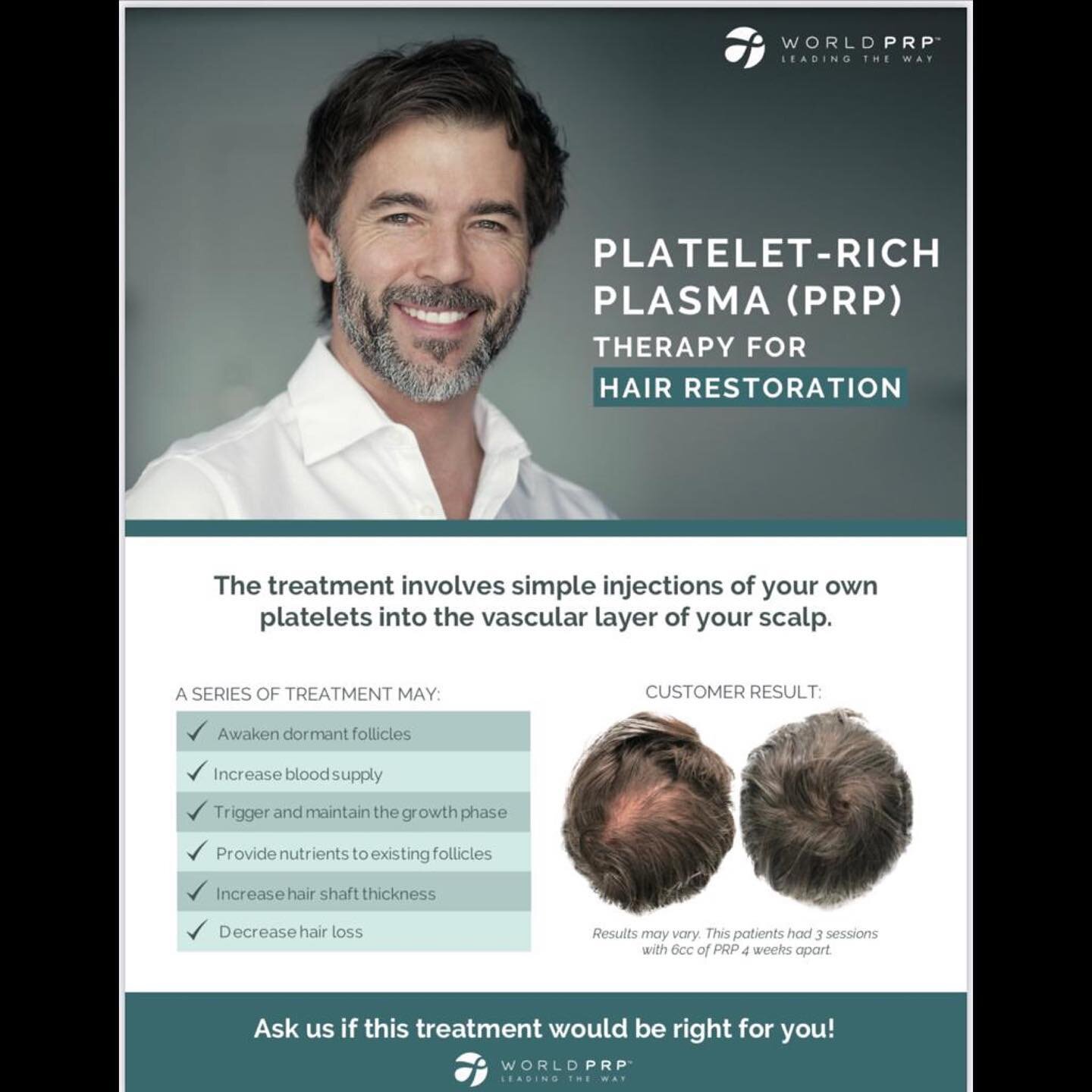 Experiencing hair loss? WorldPRP is now available at the ART Clinic!

Fall promo! World PRP 3 treatment package $1400 (regular price 2250.00) limited time only! 

DM, call or e-mail us to see if you&rsquo;re a candidate and to learn more about WorldP