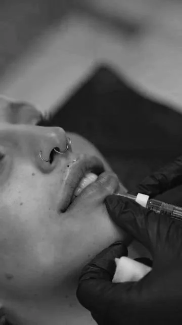 A person receiving a lip injection by a professional wearing gloves.