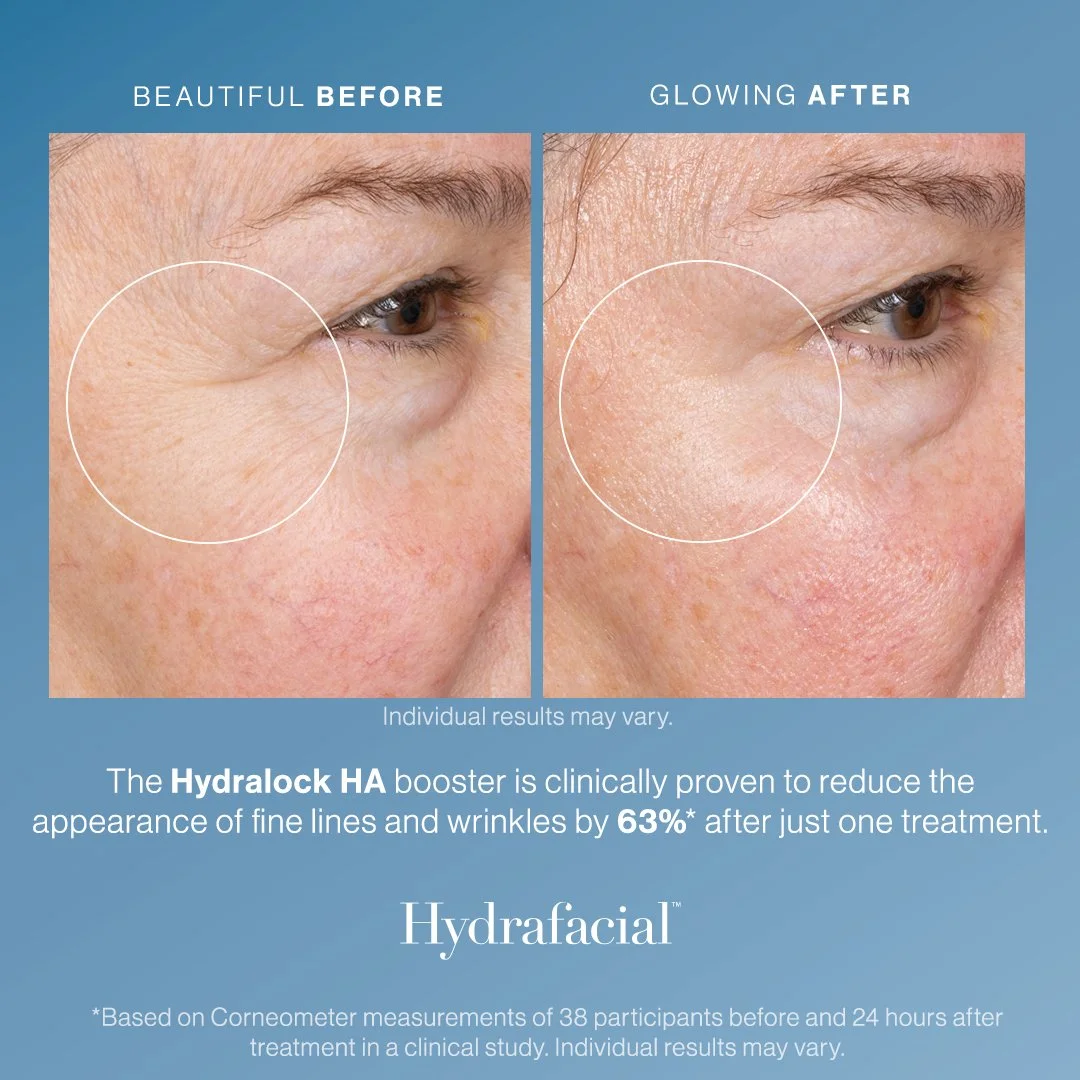 Hydralock Before/After