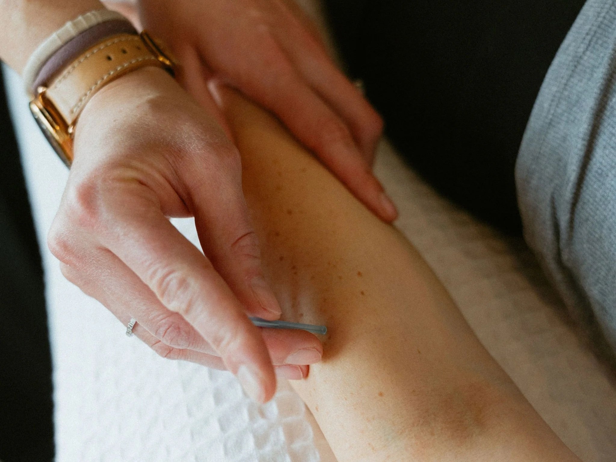 Community Acupuncture: An Introduction + Mini Session with Dr. Alex Herman