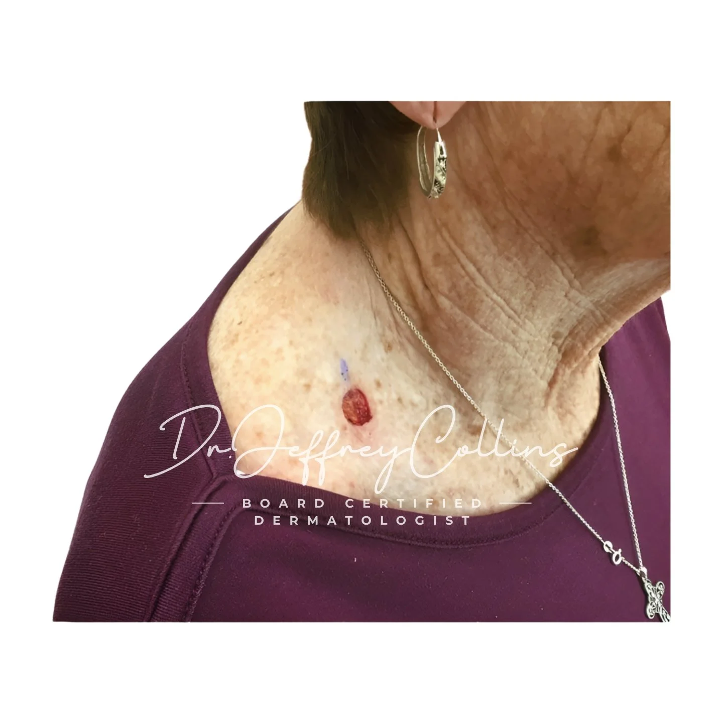 3578627__R_clavicular_neck2.jpg