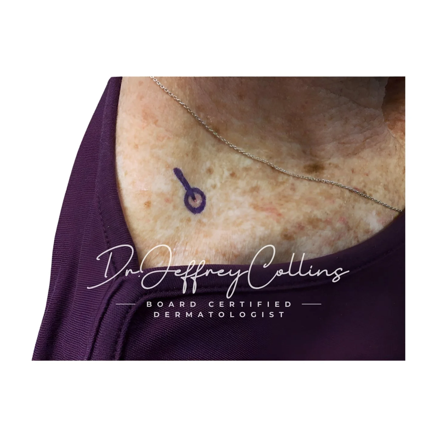 3578627__R_clavicular_neck.jpg