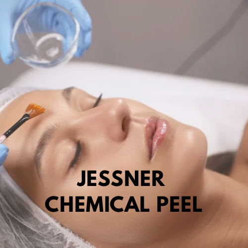 TCA CHEMICAL PEEL - 2.png