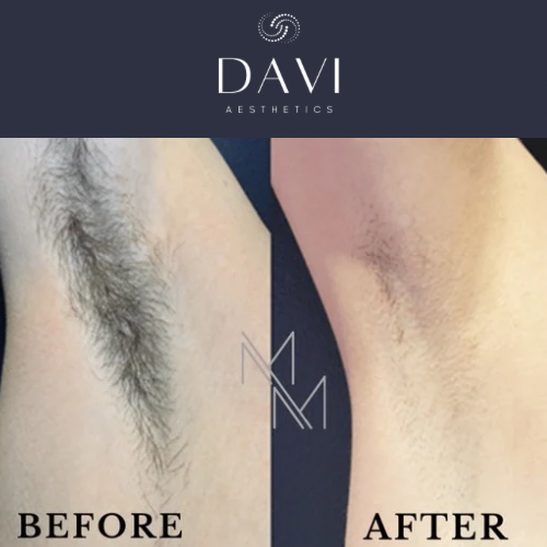 after (Logo) - 3.png