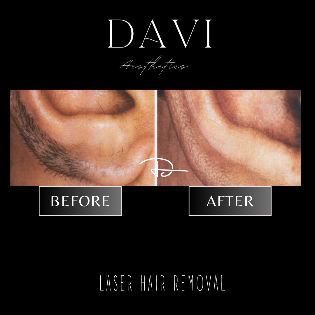 Before and after - 5.PNG