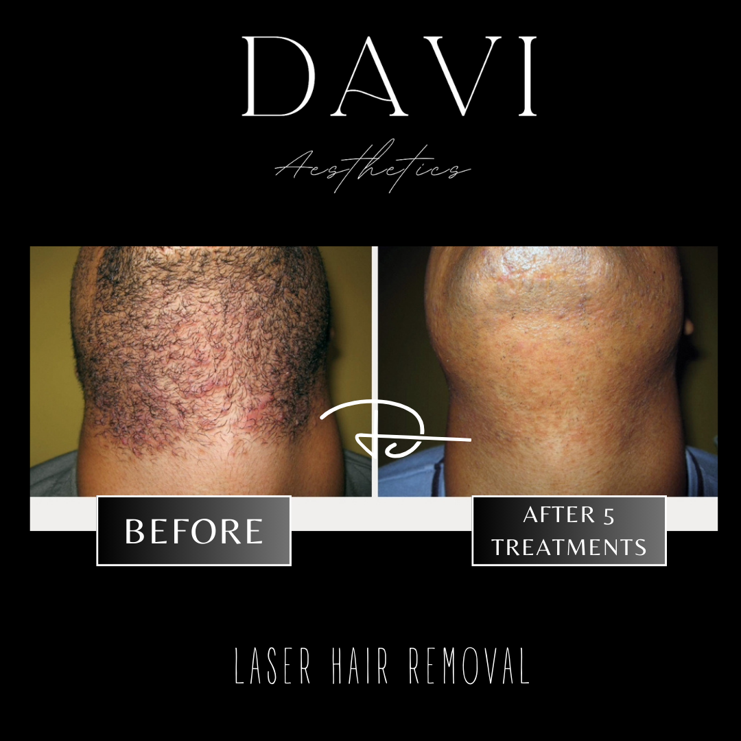 Before and after - 4.PNG