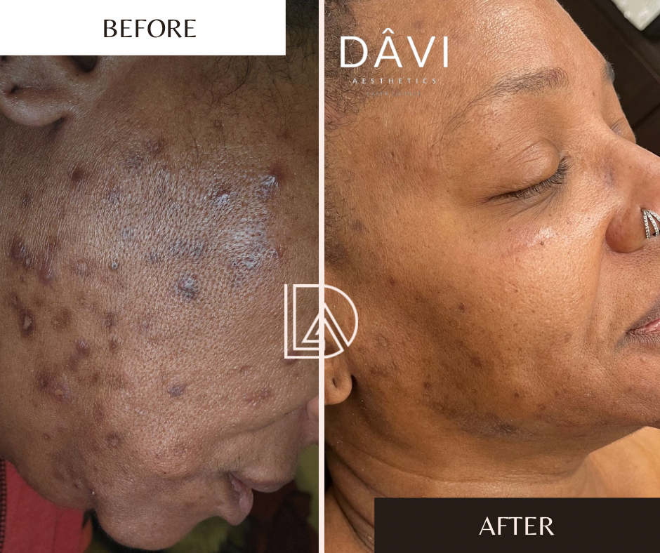 Before and After Minimal Photocentric facebook post.PNG