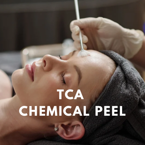TCA CHEMICAL PEEL - 1.png