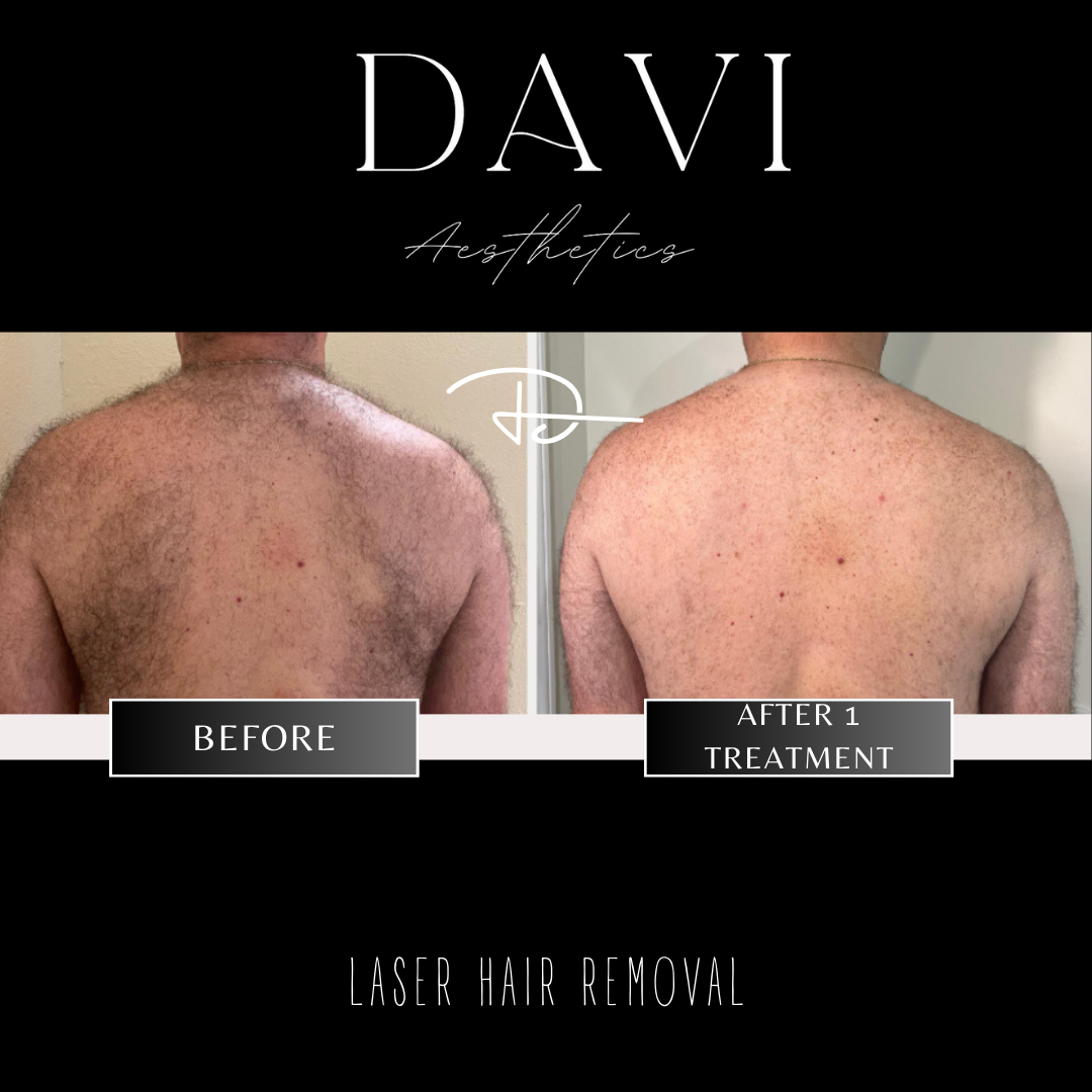 Before and after - 2.PNG