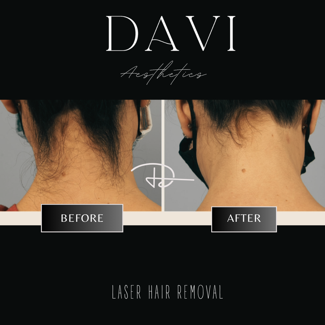 Before and after - 1.PNG