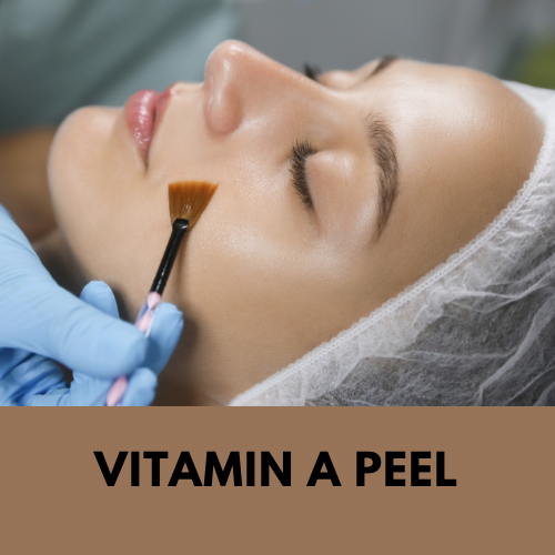 TCA CHEMICAL PEEL.png