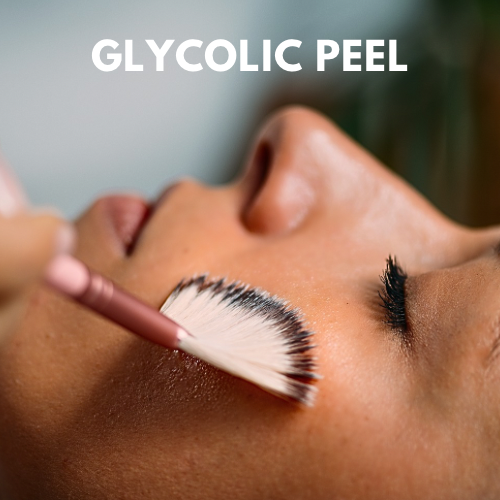 TCA CHEMICAL PEEL - 3.png